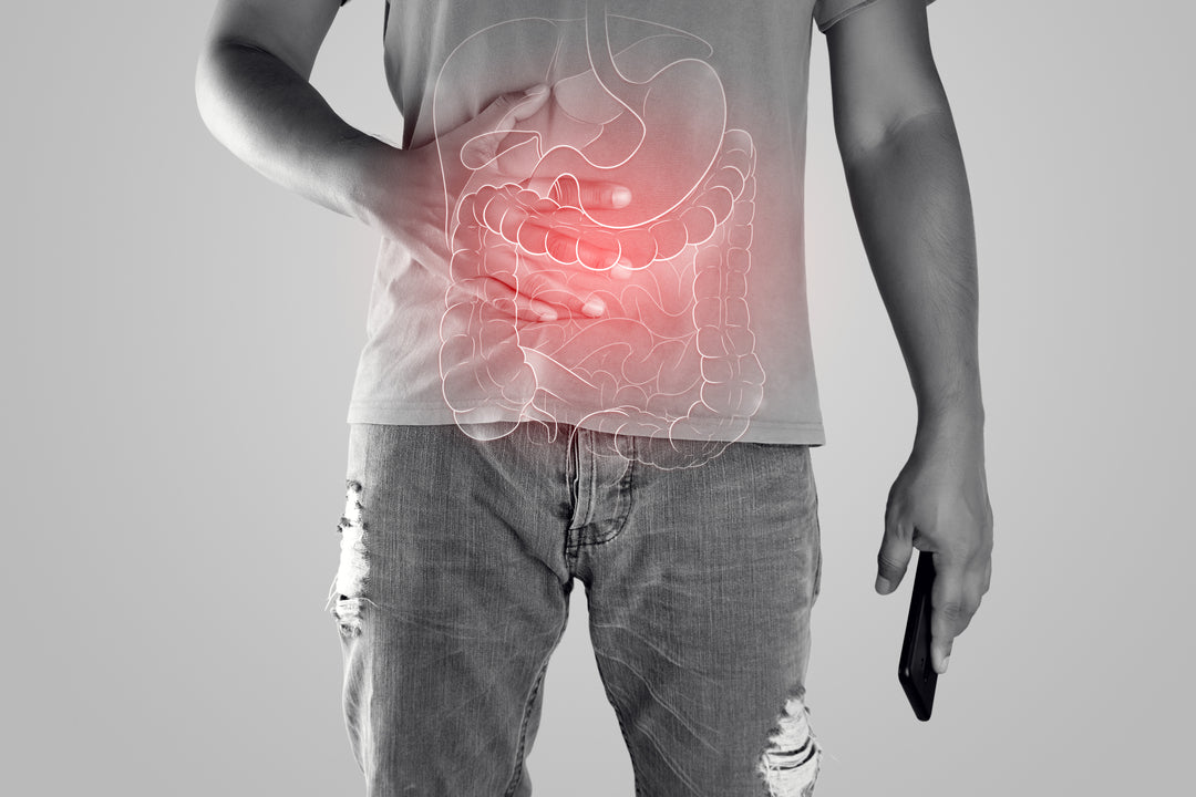 Síndrome do Intestino Irritável: o que é, sintomas e causas